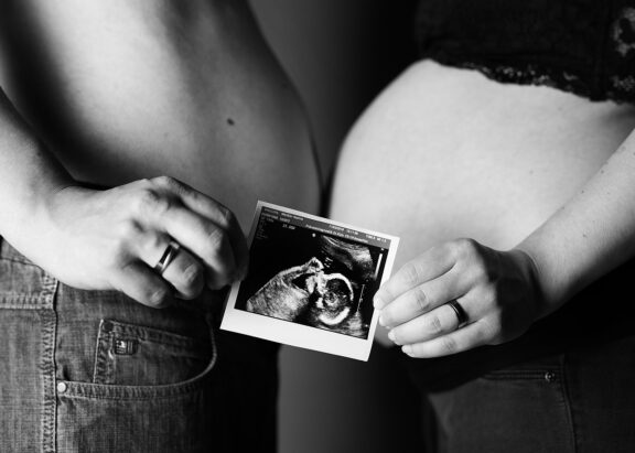 Babybauch shooting rostock babybauch bilder fotograf rostock babybauchfotos 013